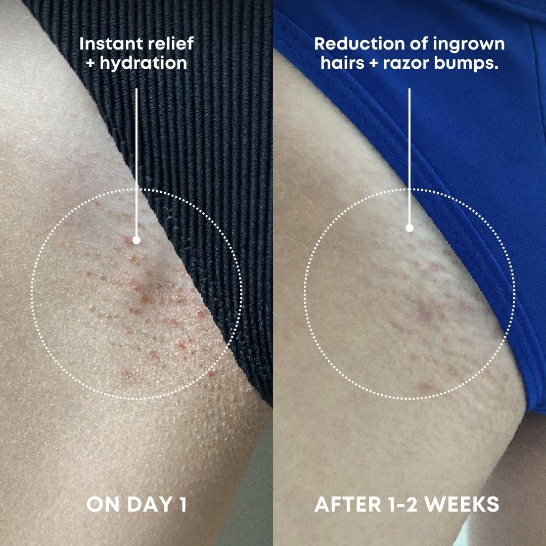 Bushbalm Ingrown Hair Exfoliating Scrub – Pre-Shave Sugar Scrub for Ingrown Hairs, Razor Bumps & Dry Skin – Gently Buffs & Soothes Sensitive Skin – Nude, 236ml
