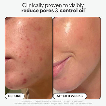 Paula's Choice SKIN PERFECTING 2% BHA Salicylic Acid Exfoliating Pads - Facial Exfoliant Pads for Blackheads, Enlarged Pores, Wrinkles & Fine Lines