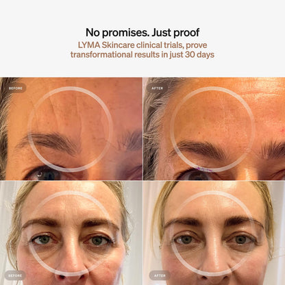 Skincare Serum Cream Starter Kit