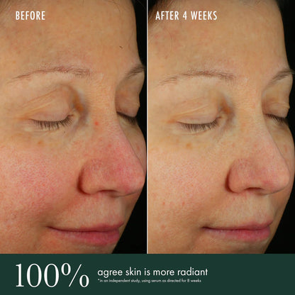 RéVive Brightening Serum - Skincare with Vitamin C, Niacinamide and Bio-Renewal Peptide - Evens Skin Tone, Refines Skin Texture and Reduces Wrinkles