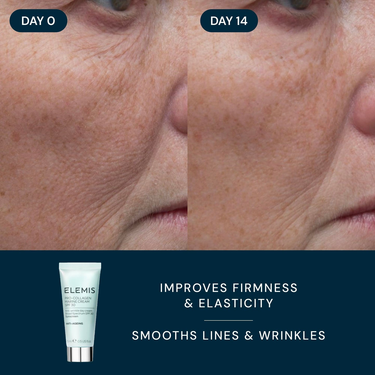 ELEMIS Healthy Skin Exclusive Travel Set | Pro-Collagen Cleansing Balm Mini, Marine Cream SPF 30 Mini & Dynamic Resurfacing Pads | Anti-Aging Hydrating Skincare Travel Kit