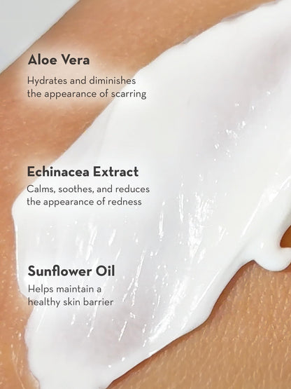 SONAGE Botanica Souffle Cream | Lightweight, Nourishing Daily Moisturizer | Improves Natural Hydration & Restores Skin Barrier