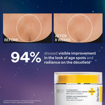 StriVectin TL Advanced Holiday Duo Tighten and Sculpt Kit, Brighten and Lift Skin Tone, Peptides and Hyaluronic Acid