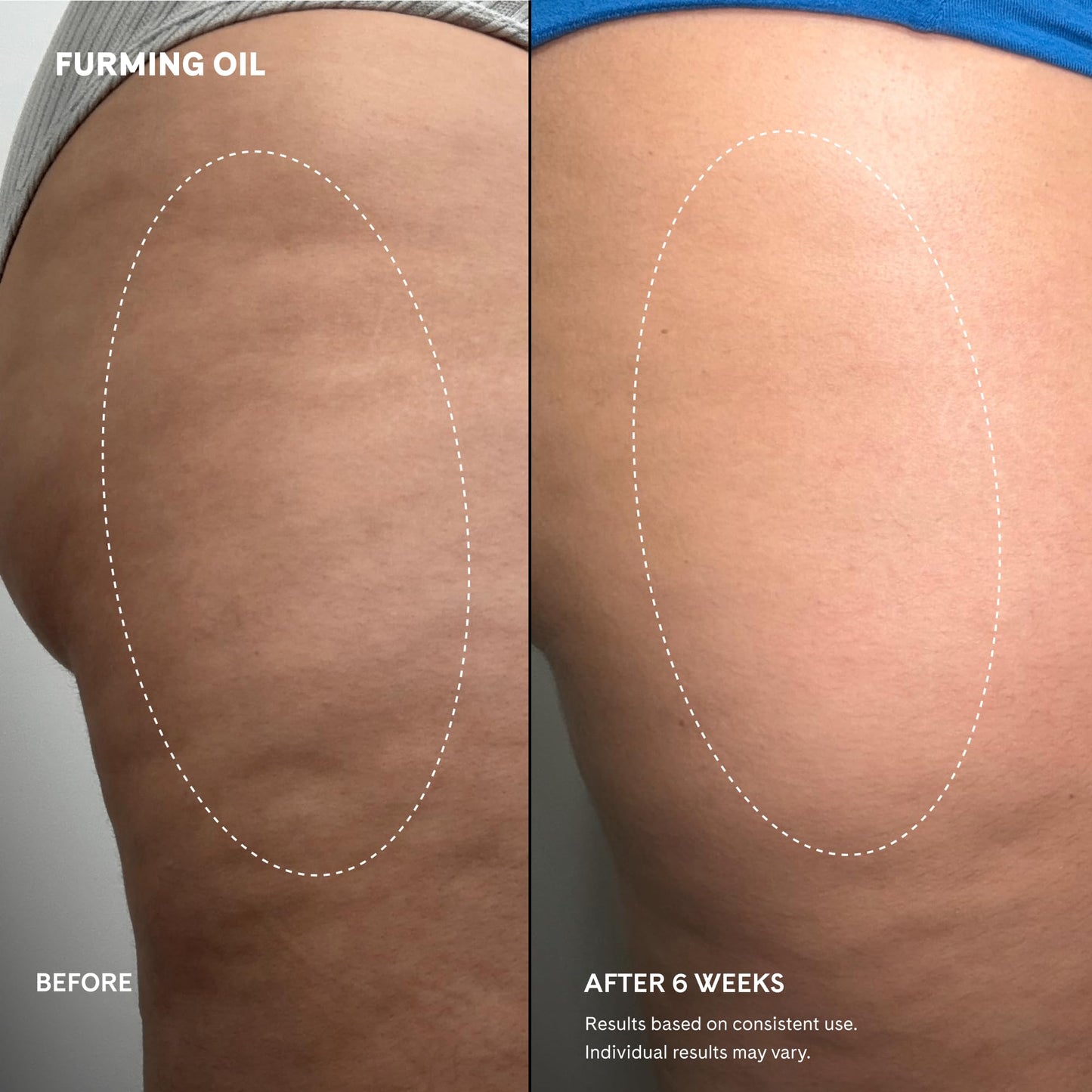 Fur Furming Oil Firming Body Oil with Bakuchiol Retinol Alternative, Hydrating Body Oil for Smoother, Firmer-Looking Skin, Lightweight Body Moisturizing Oil for Butt, Thighs & Body