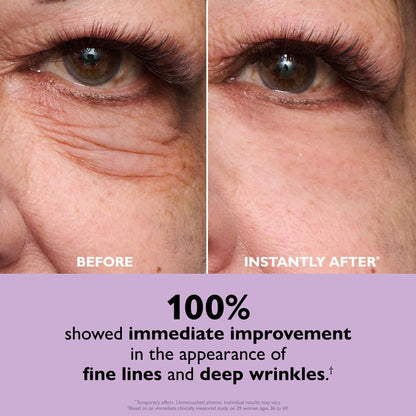 Peter Thomas Roth | Trial-Size Instant FIRMx® Eye Temporary Eye Tightener Easy-Wear Formula | Viral Eye Tightener Cream for Under-Eye Bags & Wrinkles