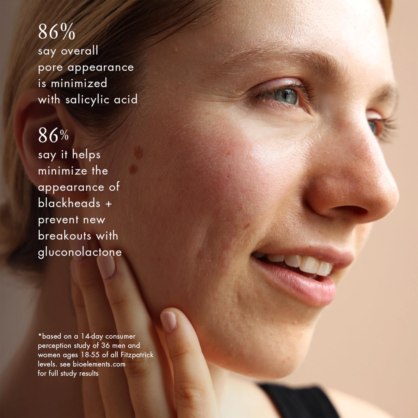 Bioelements Peel Breaker - 1 fl oz - 2% BHA + PHA Leave-On Liquid Exfoliating Treatment to Break Up Pore Blockage Oils + Dead Cells - Vegan, Gluten Free - Never Tested on Animals
