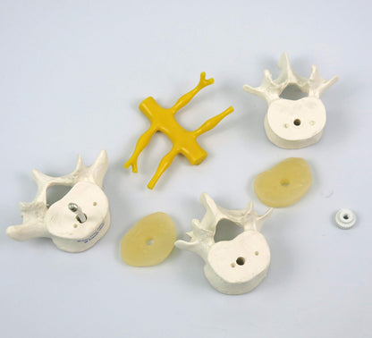 3B Scientific A76/8 3 Lumbar Vertebrae Flexibly Mounted + Free Anatomy App - 3B Smart Anatomy