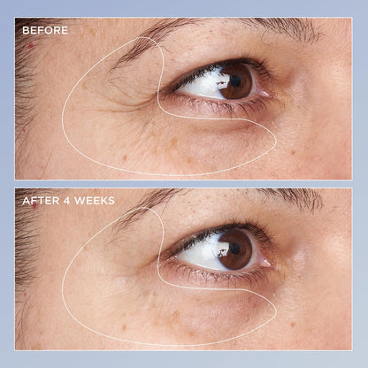 Perricone MD High Potency Triple Retinol Renewal Eye Serum, 0.5 fl. oz.