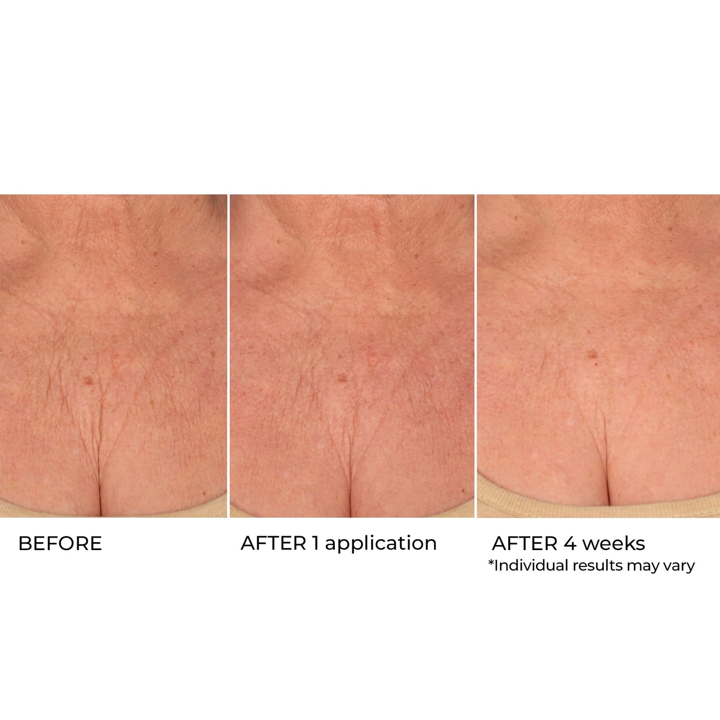 NassifMD Age Defying Neck & Décolleté Serum, Lifts and Firms Thin Neck Skin, Hydrates and Smooths