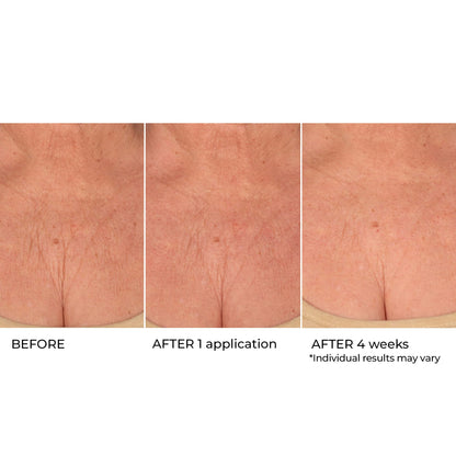 NassifMD Age Defying Neck & Décolleté Serum, Lifts and Firms Thin Neck Skin, Hydrates and Smooths