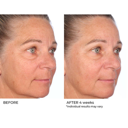 NASSIFMD Restore & Firm Face Oil with CoQ10 – Clinically Tested Treatment Oil to Restore Skin Quality and Visibly Improve Firmness, Smooth Fine Lines & Enhance Radiance