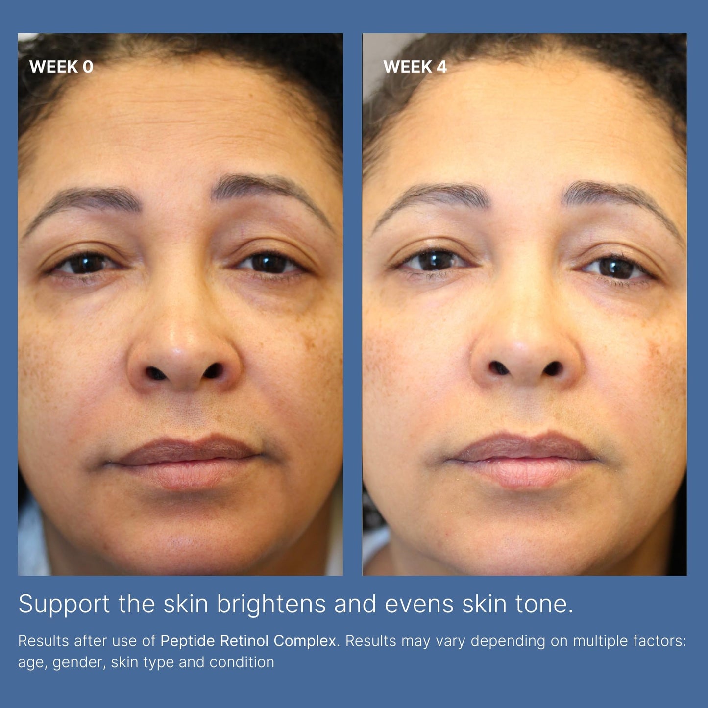 Nu Skin | ageLOC Tru Face Peptide Retinol Complex | 1 Fl Oz | Serum Skincare | Anti Aging Face Serum | Pore Minimizing | Peptide Facial Skin Care Product