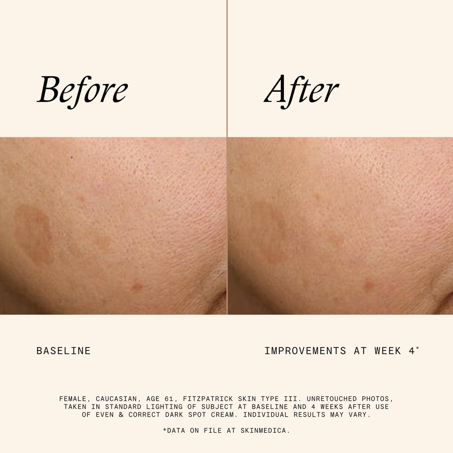 Even & Correct Dark Spot Cream - For Reducing the Most Stubborn Dark Spots