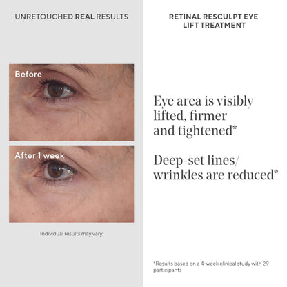 Murad Retinal ReSculpt Eye Lift Treatment - Age-Defying Eye Cream with Encapsulated Retinal, Gentian Root, & Oat-Firming Film for Youthful Eyes - Tightens Droopy Lids & Under-Eye Bags - 0.5 Fl Oz