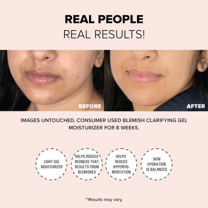 Nudestix Blemish Clarifying Gel Moisturizer – Lightweight Salicylic Acid Acne Treatment with Niacinamide, Cica & Hyaluronic Acid | Hydrating, Vegan Daily Face Moisturizer for Clear, Balanced Skin