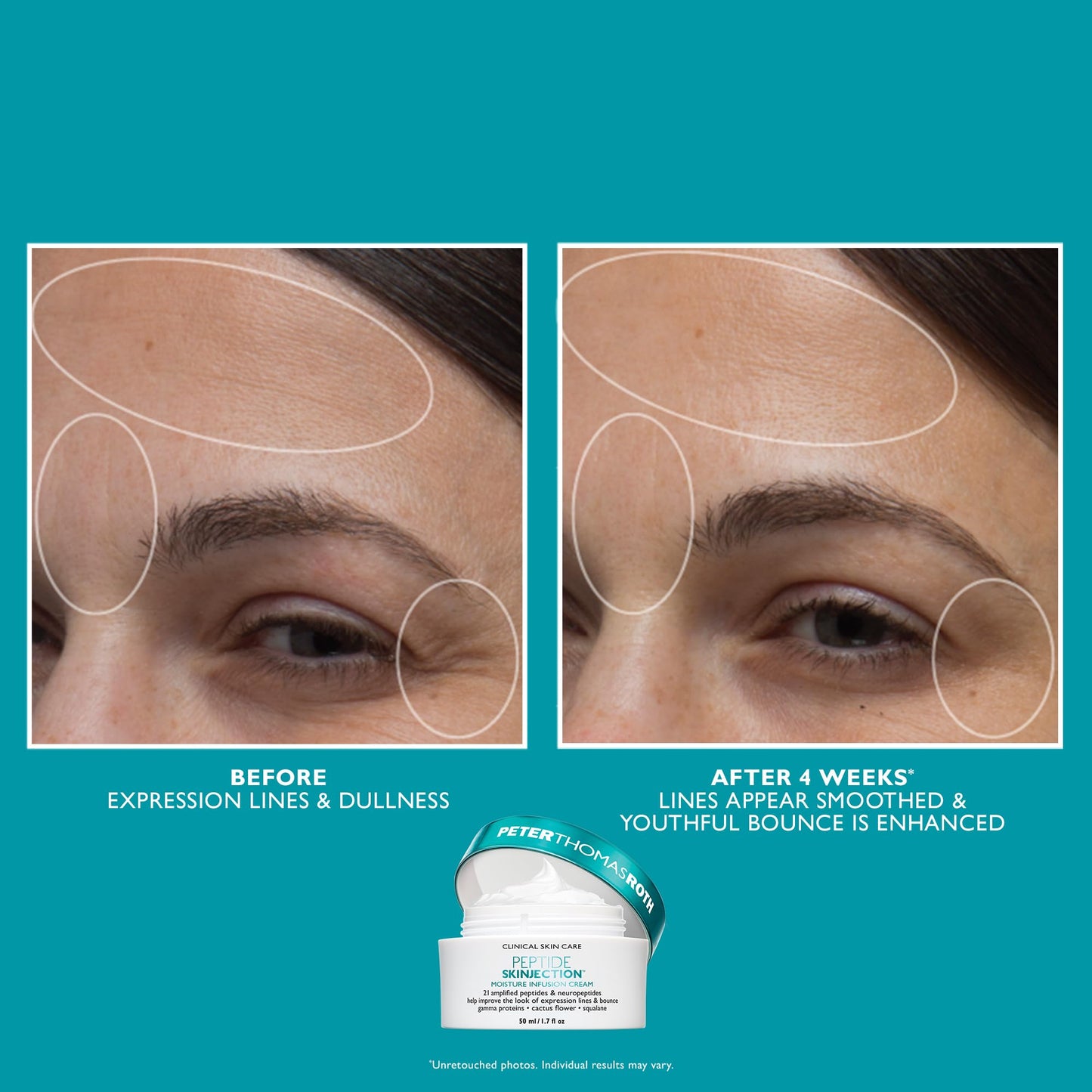 Peter Thomas Roth | Full-Size Peptide Skinjection™ Solutions 2-Piece Face & Eye Kit | Anti-Aging Peptide Skincare Set, Under-Eye Cream and Moisturizer