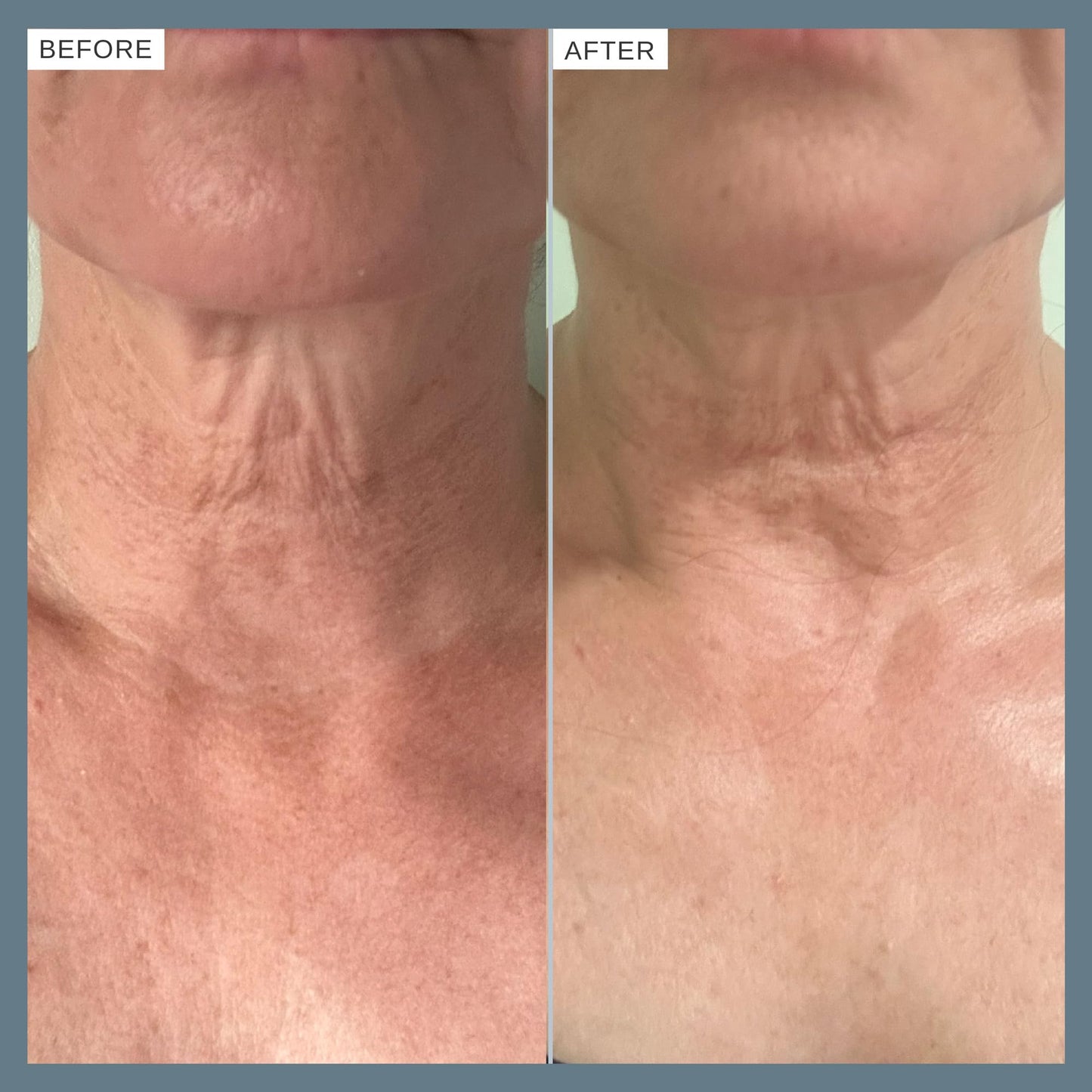 Alpha-H Firming Peptide Body Oil