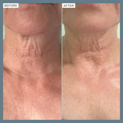 Alpha-H Firming Peptide Body Oil