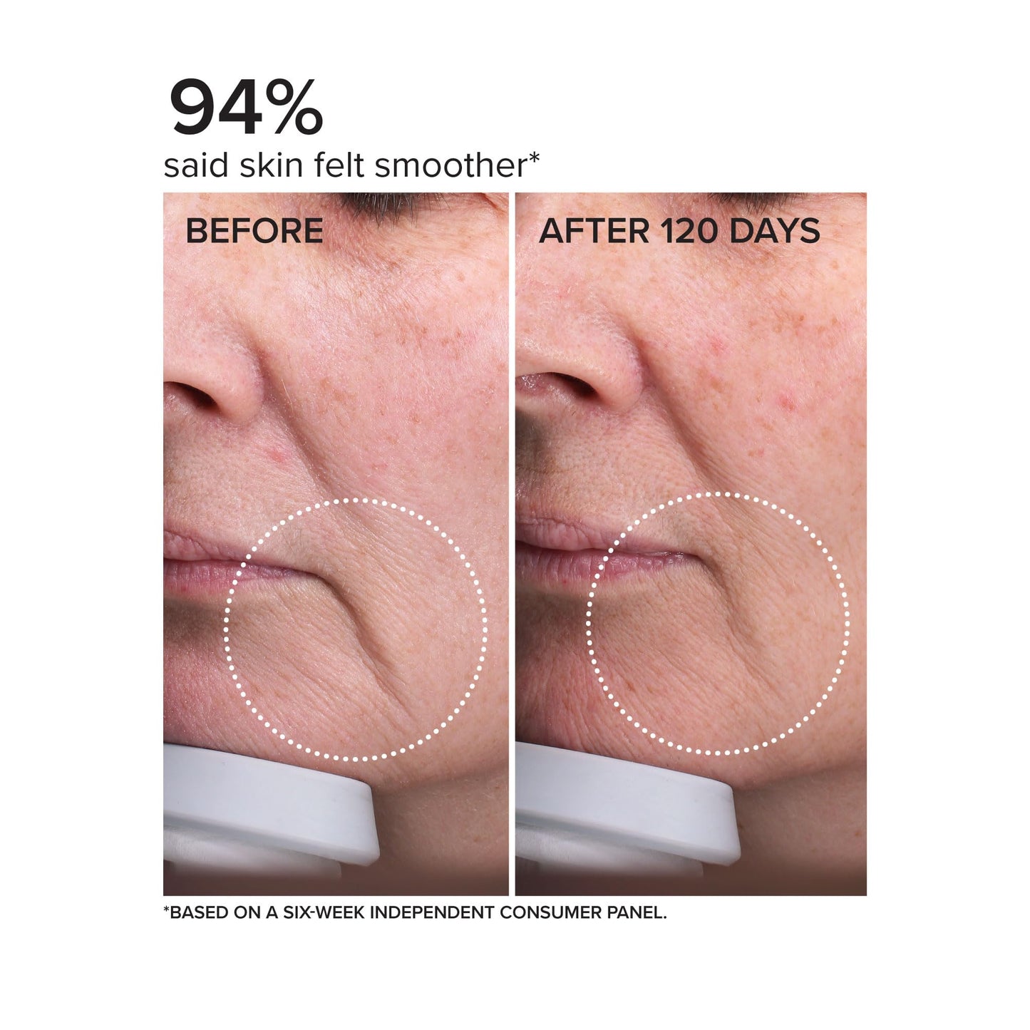DRMTLGY Needle-less Serum - Anti-Aging Serum for Fine Lines & Wrinkles - Niacinamide with Potent Blend of Hyaluronic Acid, Peptides & Ceramides, 1 fl oz