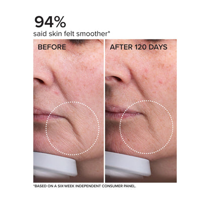 DRMTLGY Needle-less Serum - Anti-Aging Serum for Fine Lines & Wrinkles - Niacinamide with Potent Blend of Hyaluronic Acid, Peptides & Ceramides, 1 fl oz