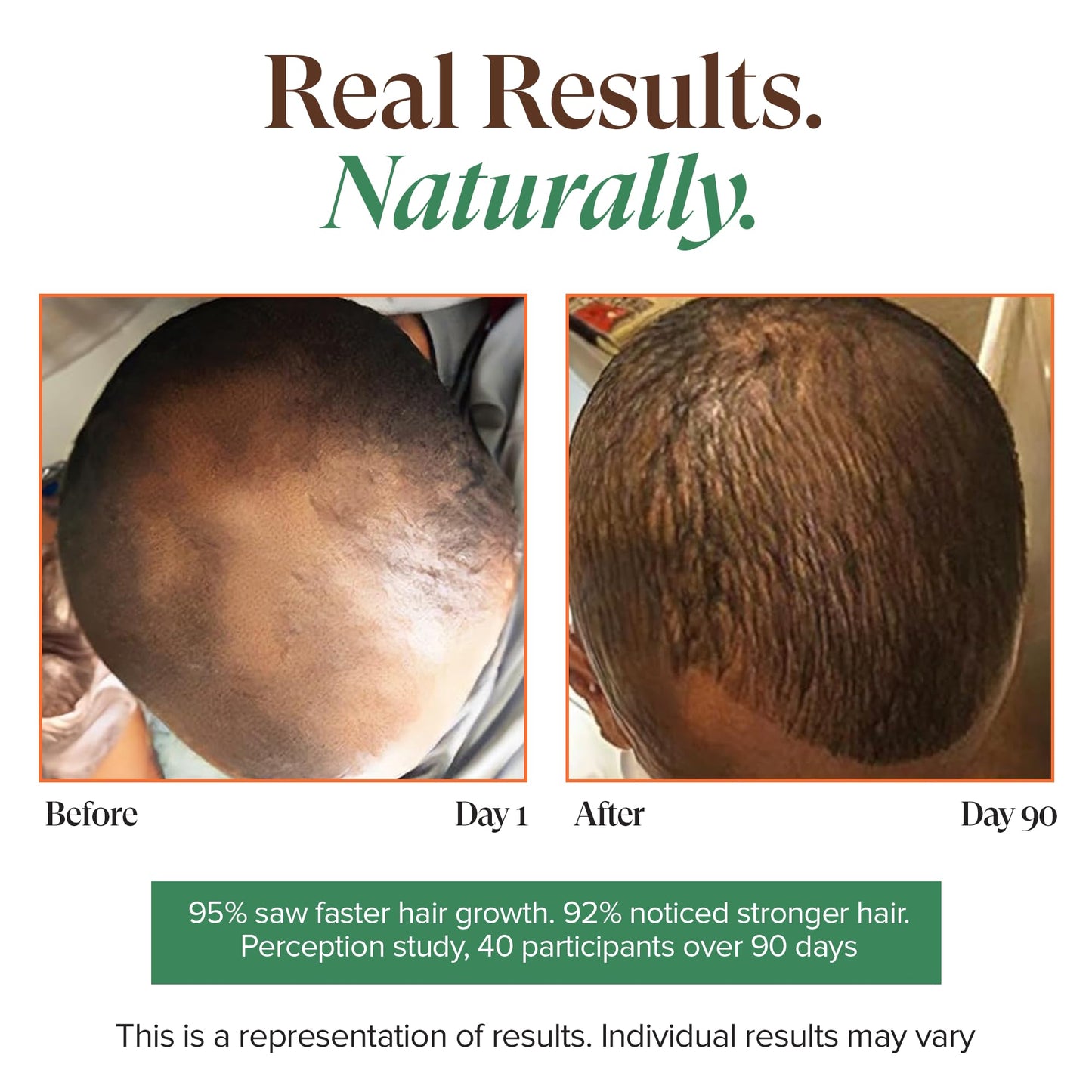 Kreyol Essence - Haitian Black Castor Oil for Skin and Hair, Glass Bottle - Cold Pressed Castor Oil, Fuller-Looking Hair, Hexane Free, Natural Humectant | 3.4 Fl Oz | Rosemary Peppermint