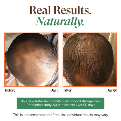 Kreyol Essence - Haitian Black Castor Oil for Skin and Hair, Glass Bottle - Cold Pressed Castor Oil, Fuller-Looking Hair, Hexane Free, Natural Humectant | 3.4 Fl Oz | Rosemary Peppermint