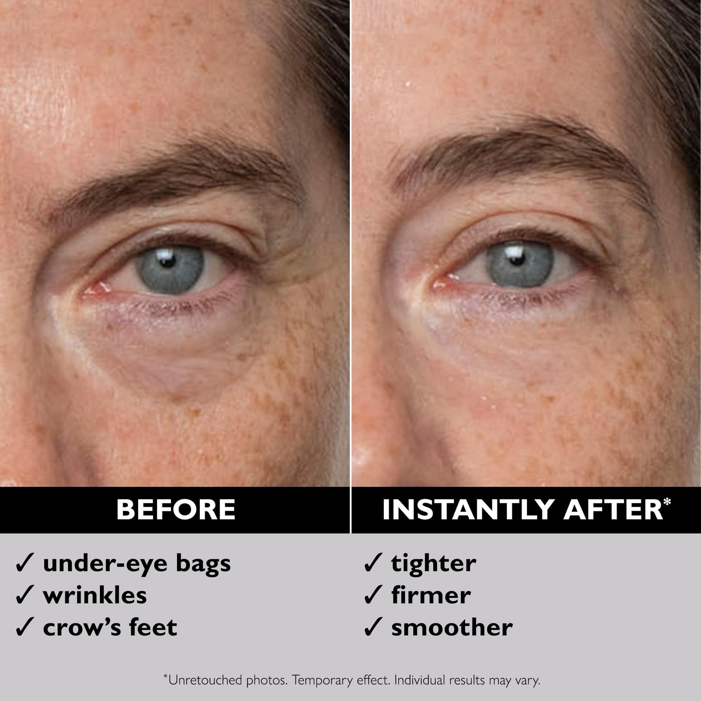 Peter Thomas Roth | Instant FIRMx Eye Temporary Eye Tightener Easy-Wear Formula (Pack of 2)