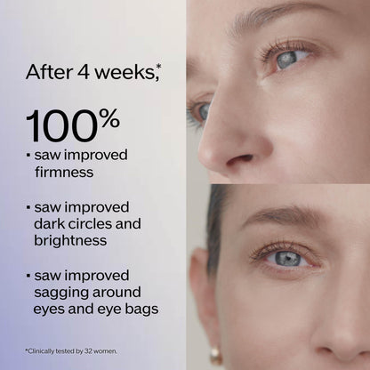 Shiseido Lifting & Firming Eye Care Set - Eudermine Activating Essence (30mL), Vital Perfection Uplifting and Firming Advanced Cream (15mL) & Eye Cream (15mL) - $159 Value