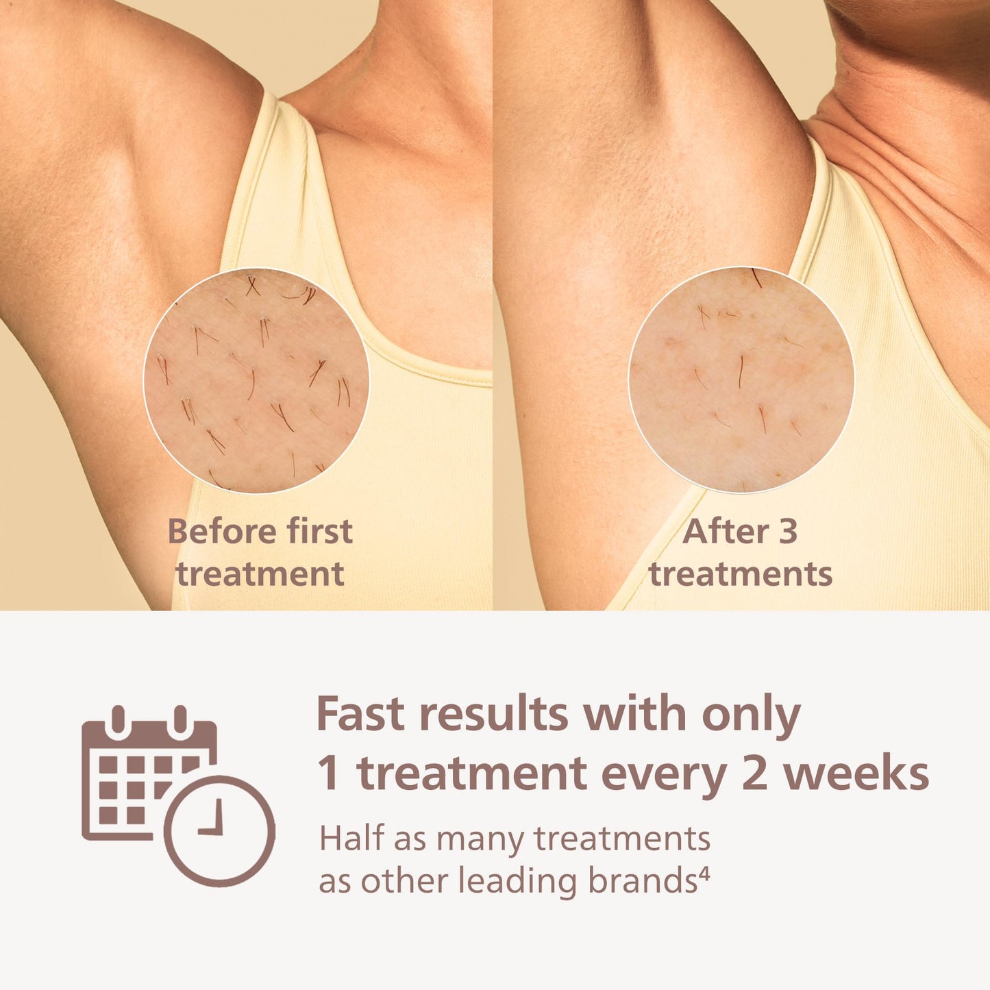 Philips Lumea 8000 Series IPL Hair Removal Device, Permanent Laser Hair Reduction for Women & Men, Easy and Comfortable Use at Home, SenseIQ, 3 Attachments for Body, Face, Intimate, BRI937/03