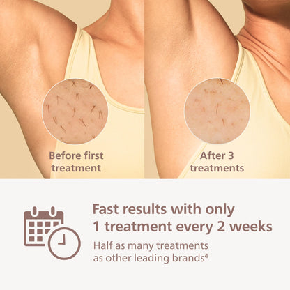 Philips Lumea 8000 Series IPL Hair Removal Device, Permanent Laser Hair Reduction for Women & Men, Easy and Comfortable Use at Home, SenseIQ, 3 Attachments for Body, Face, Intimate, BRI937/03