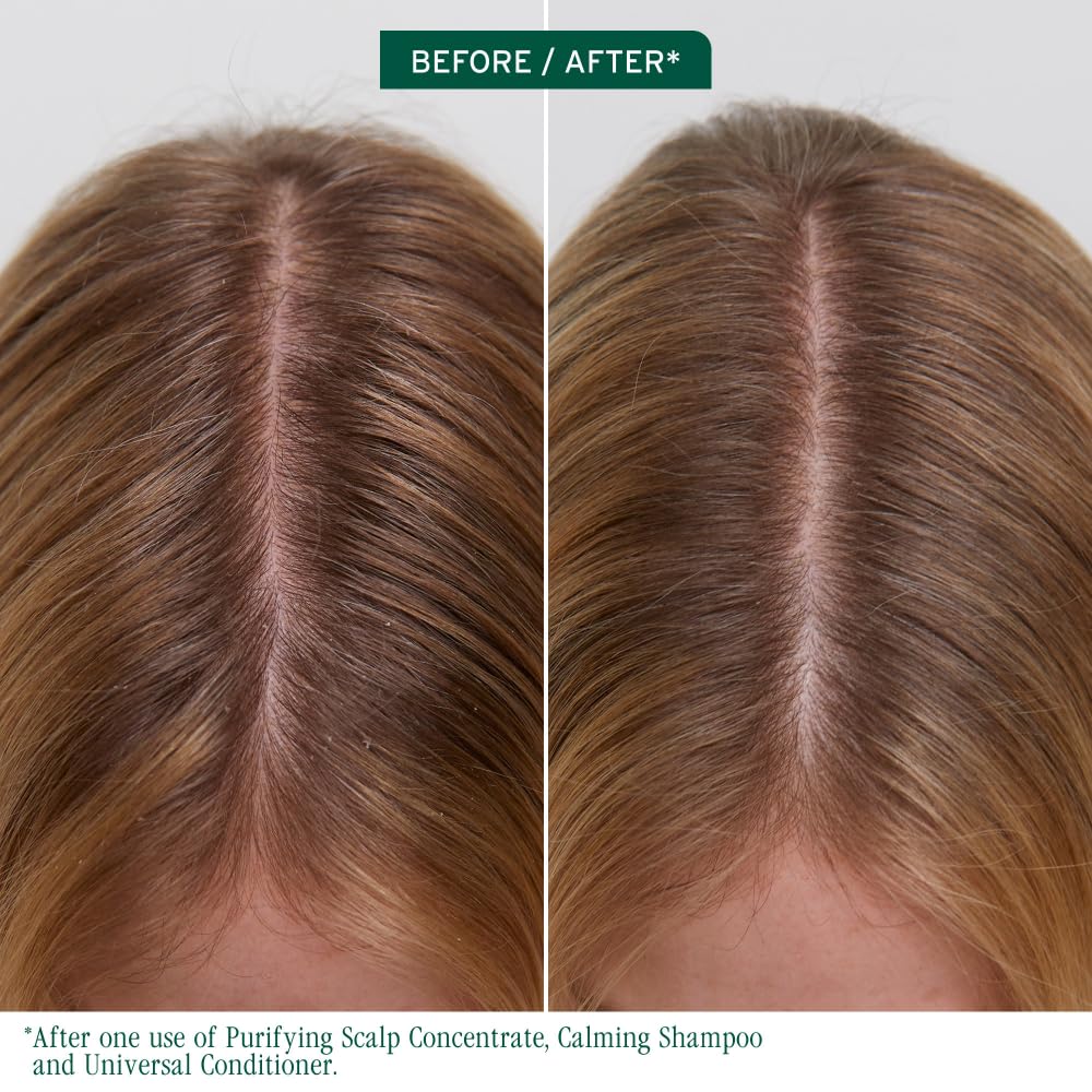 Biolage Scalp Sync Purifying Concentrate - Exfoliating & Clarifying Dry Scalp Treatment, Refreshing & Reinvigorating, Fermented Tea Blend & Glycolic Acid