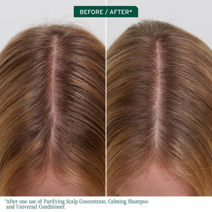 Biolage Scalp Sync Purifying Concentrate - Exfoliating & Clarifying Dry Scalp Treatment, Refreshing & Reinvigorating, Fermented Tea Blend & Glycolic Acid