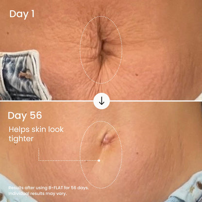 MAËLYS B-FLAT Belly Firming Cream for Women - Skin Tightening & Moisturizing Treatment with Shea Butter & Bentonite Clay - Smooths Look of Stretch Marks - Postpartum Body Care (3.4 Fl Oz)