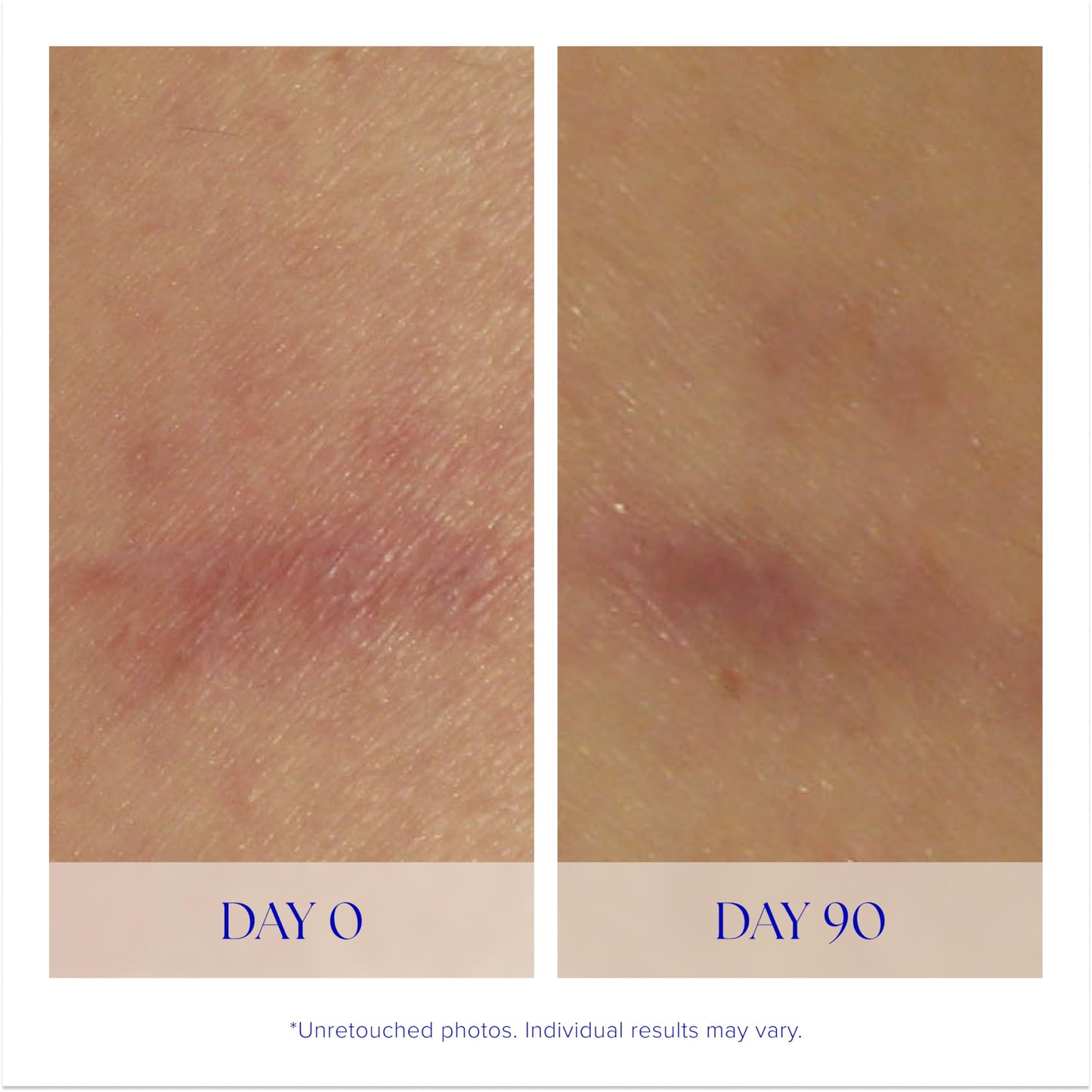iS CLINICAL Super Serum Advance+, Anti-Aging Vitamin C Face Serum, reduces scaring and fine stretch marks