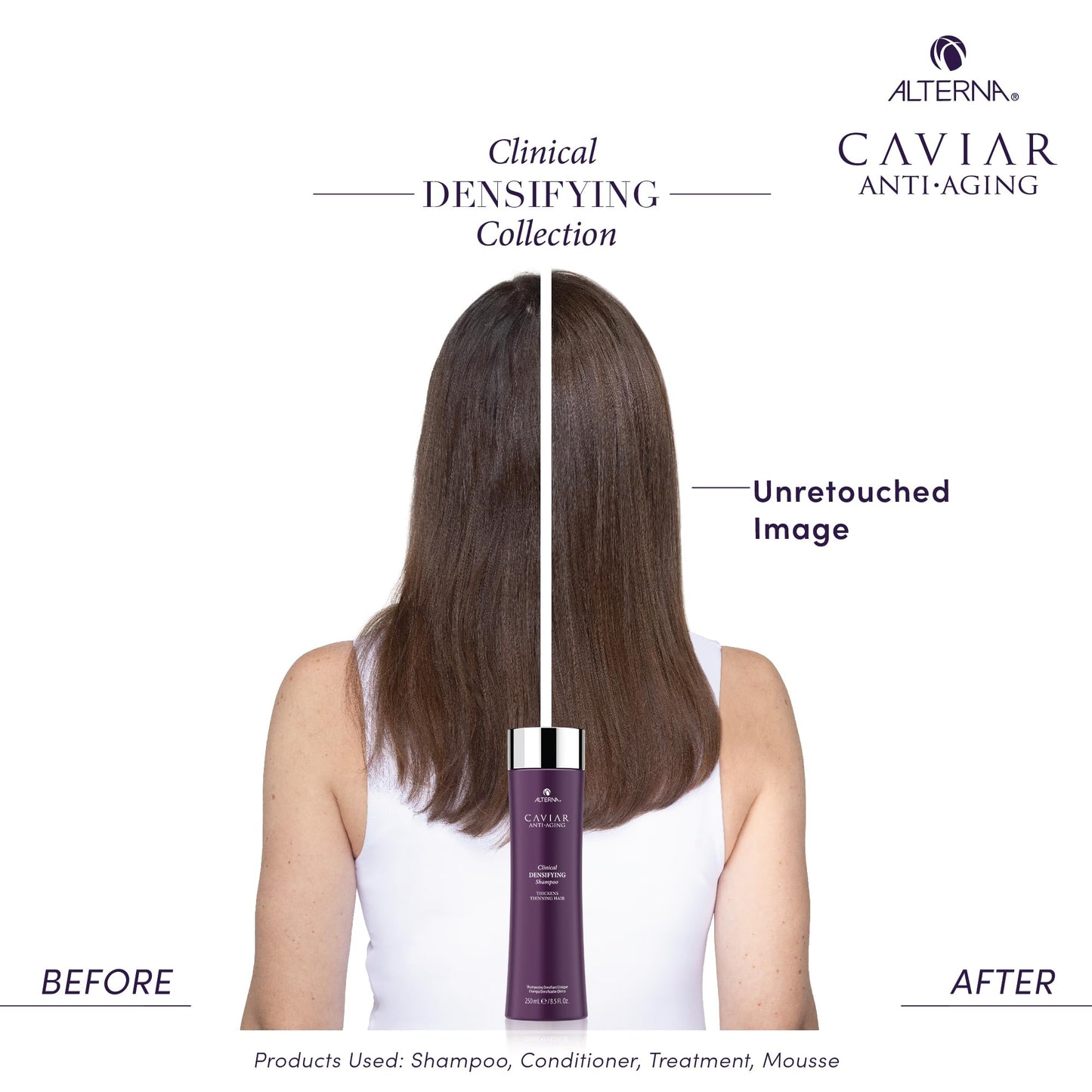 CAVIAR Anti-Aging Clinical Densifying Shampoo | For Fine, Thinning Hair | Thickens Hair, Protects Scalp | Sulfate Free