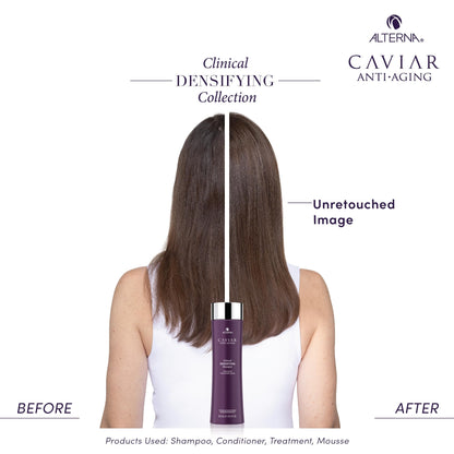 CAVIAR Anti-Aging Clinical Densifying Shampoo | For Fine, Thinning Hair | Thickens Hair, Protects Scalp | Sulfate Free
