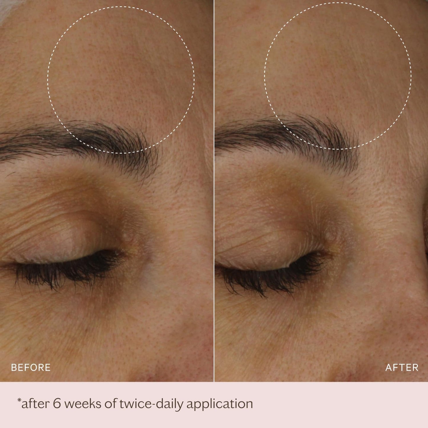 MZ SKIN The Light Moisturiser 1.69 fl oz | Hydrating Anti-Aging Face Cream with Hyaluronic Acid, Bio-Identical Collagen & Peptides | Oil-Free Feel, Firms & Brightens