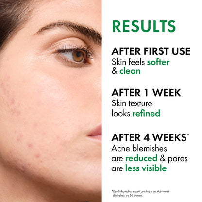 VICHY Normaderm Acne Control Daily Moisturizer, Oil Free Acne Moisturizer For Face, Max Strength 2% Salicylic Acid + Hyaluronic Acid + Vitamin C, Targets Blackheads, Blemishes & Enlarged Pores