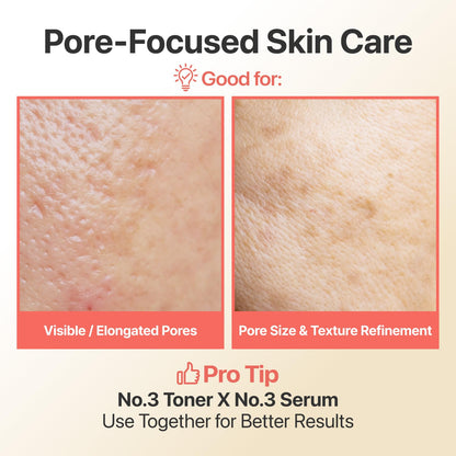 numbuzin No.3 Skin Softening Serum, Fermented Serum for Skin Texture & Pores, Bifida & Galactomyces, Niacinamide, Adenosine, Panthenol, Fragrance-Free, 1.69 fl oz (50ml)