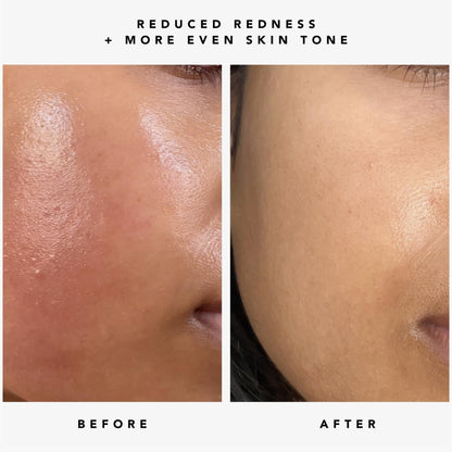 HERBIVORE AM to PM Set | Nova Serum + Moon Fruit Serum