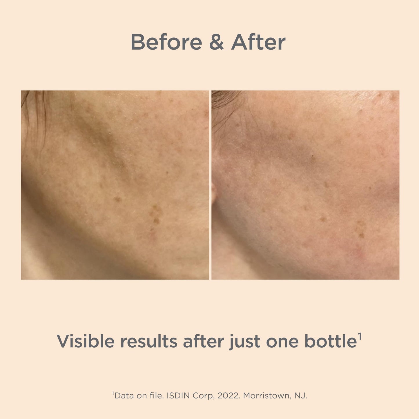ISDIN Isdinceutics Eco-Refill Melaclear Advanced - Dark Spot Corrector for Face with Niacinamide 1.7 FL OZ (50 ml).