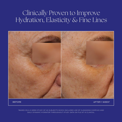iS CLINICAL Daily Dynamic Hydrator, Hydrating Anti-Aging Face Moisturizer with Hyaluronic Acid, Repairs and Protects Skin, Powered by GeneXC Technology