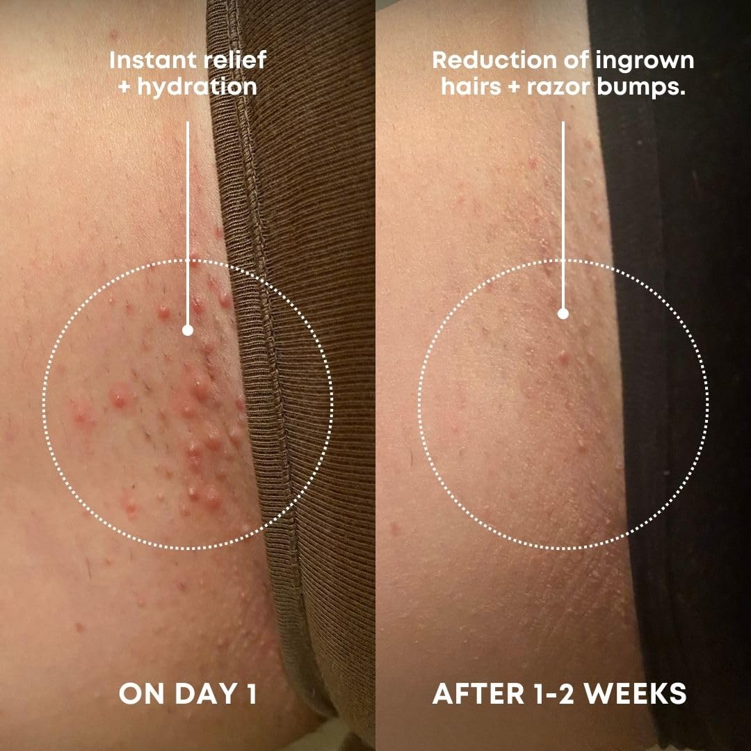 Bushbalm Ingrown Hair Exfoliating Scrub – Pre-Shave Sugar Scrub for Ingrown Hairs, Razor Bumps & Dry Skin – Gently Buffs & Soothes Sensitive Skin – Nude, 236ml