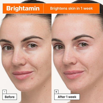 Dr.Jart+ Brightamin Brightening Korean Vitamin C and Niacinamide Serum For Visible Fine Lines | Dark Spot Correcting Glow Serum | Korean Skin Care, 0.27 Fl Oz