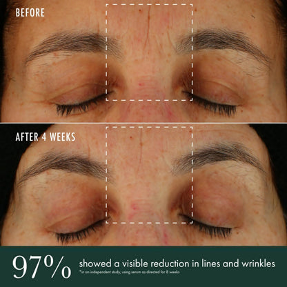 RéVive Brightening Serum - Skincare with Vitamin C, Niacinamide and Bio-Renewal Peptide - Evens Skin Tone, Refines Skin Texture and Reduces Wrinkles