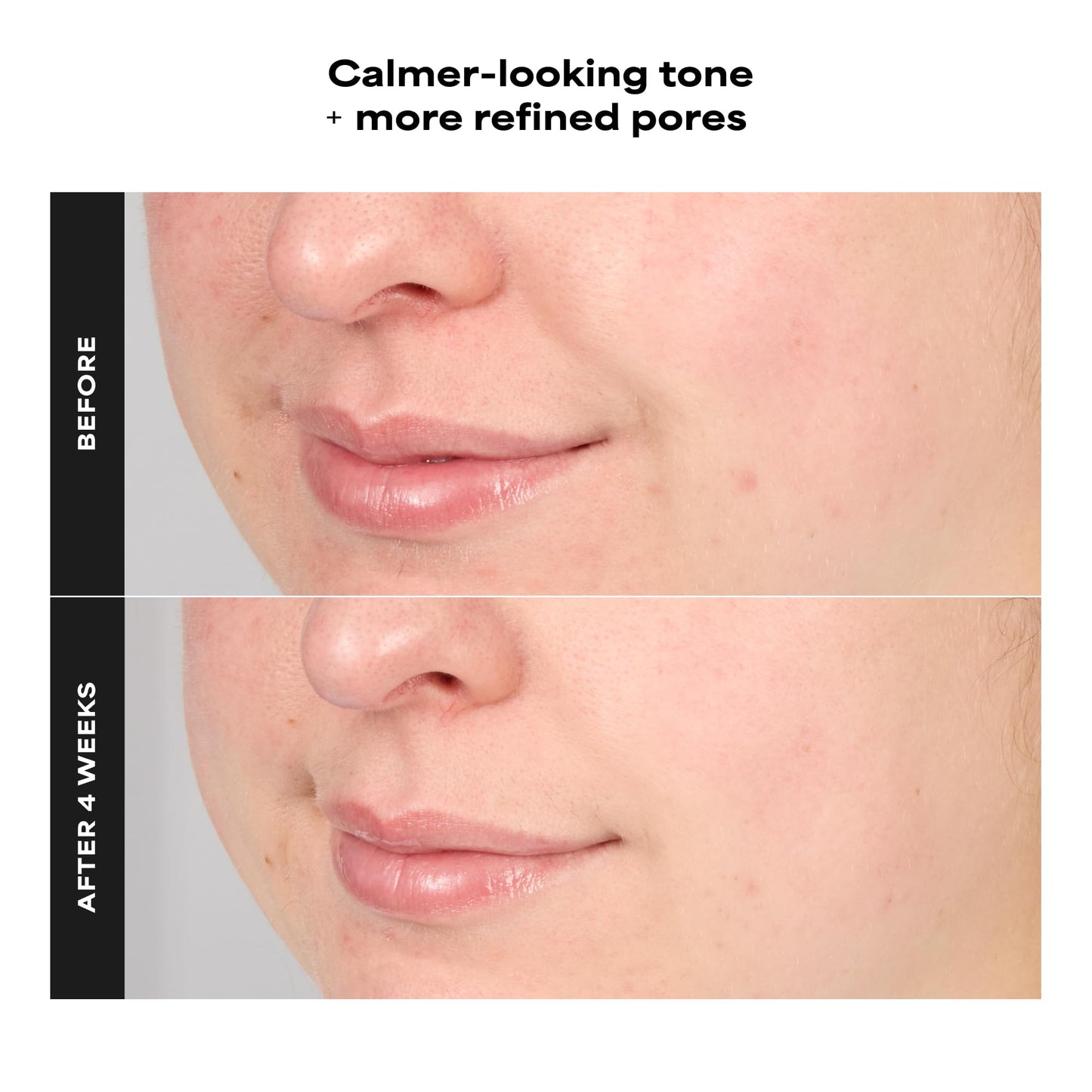 Paula's Choice RESIST Advanced Pore Refining Treatment 4% BHA Serum, Face Exfoliator with Salicylic Acid, Green Tea, Anti-Aging Exfoliant for Oily, Normal, Combination Skin, Fragrance-Free, 1 Fl Oz.