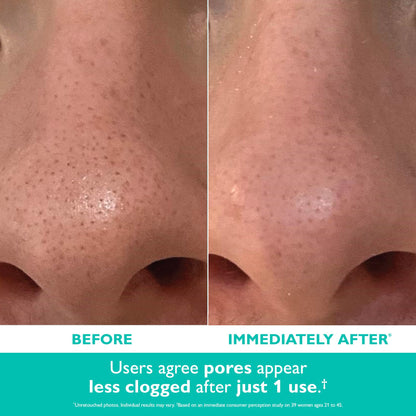 Peter Thomas Roth | Even Smoother™ Microdermabrasion Exfoliating Pore Purifier with Salicylic Acid for Oil Control