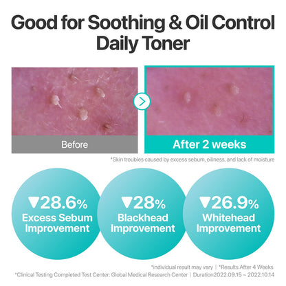 numbuzin No.1 Toner | Pure-Full Calming Herb Toner | Breakouts, Redness, Excess Oil Control | Centella Asiatica, Heartleaf, Licorice Root | Acne-Prone, Sensitive Skin | 10.14 fl. oz.