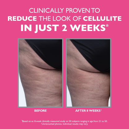 Peter Thomas Roth | FIRMx® Tight & Toned Cellulite Treatment, Body Cream, Clinically Proven to Reduce the Look of Cellulite In Just 2 Weeks