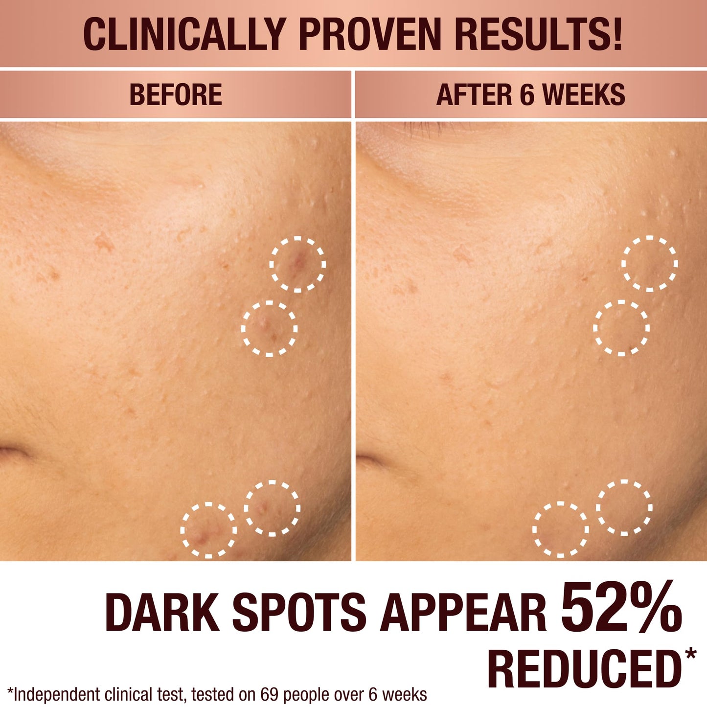 Charlotte Tilbury Radiance Recovery Dark Spot Serum - Tranexamic Acid & Vitamin C Serum for Brighter Looking Under Eyes, Redness, Uneven Skin Tone - Treatment to Reduce Appearance of Aging Skin